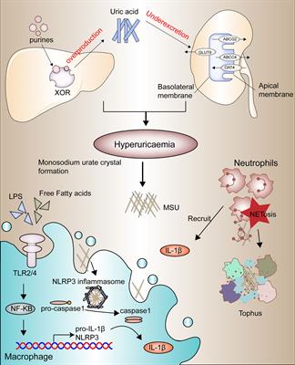 Role of microRNA alternation in the pathogenesis of gouty arthritis